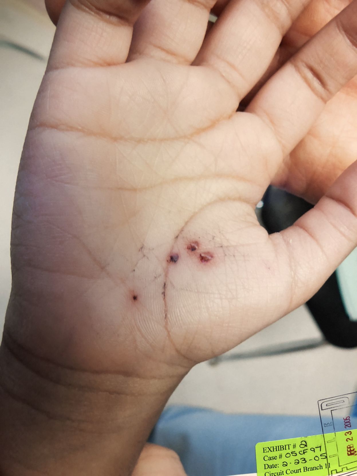 Pen marks